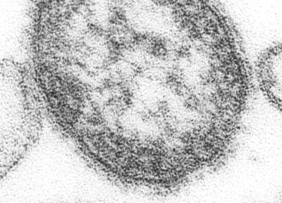 Pennsylvania Requests CDC Epi-Aid as Measles Cases Reach 731 and Deaths Hit Four